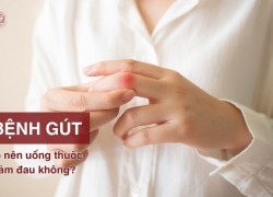 [Tư vấn] Bệnh “Gút” có nên uống thuốc giảm đau không?
